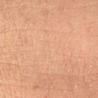 Photo Textures of Human Skin